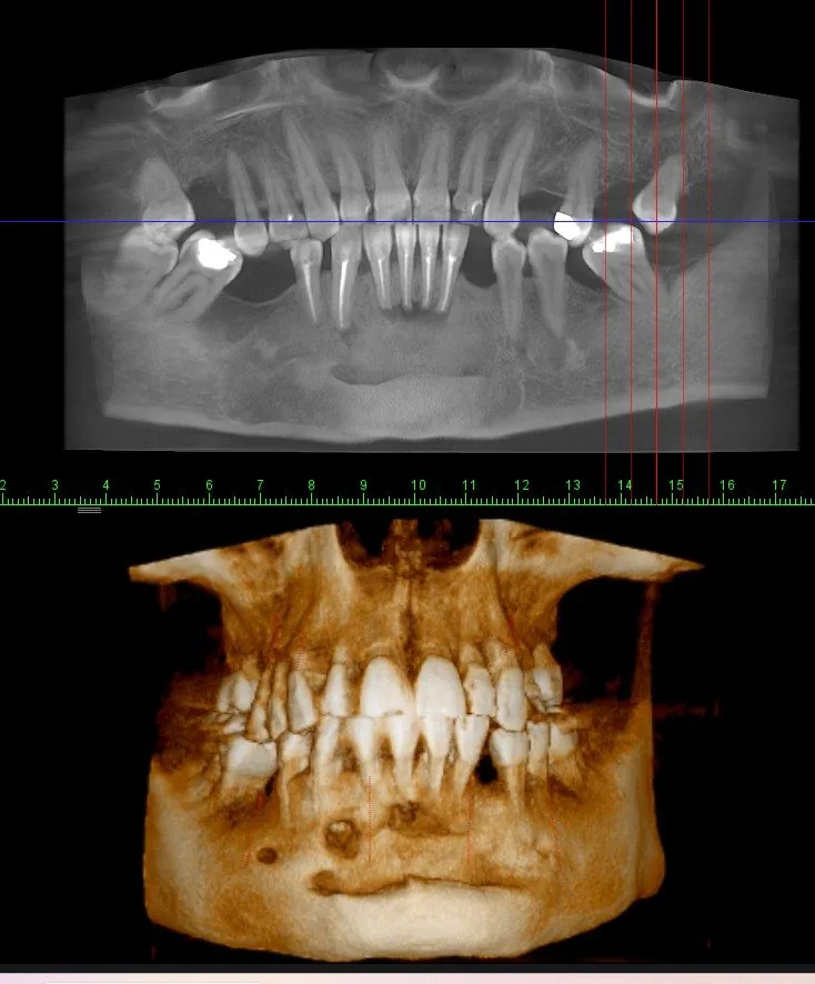 CBCT 3D snimka