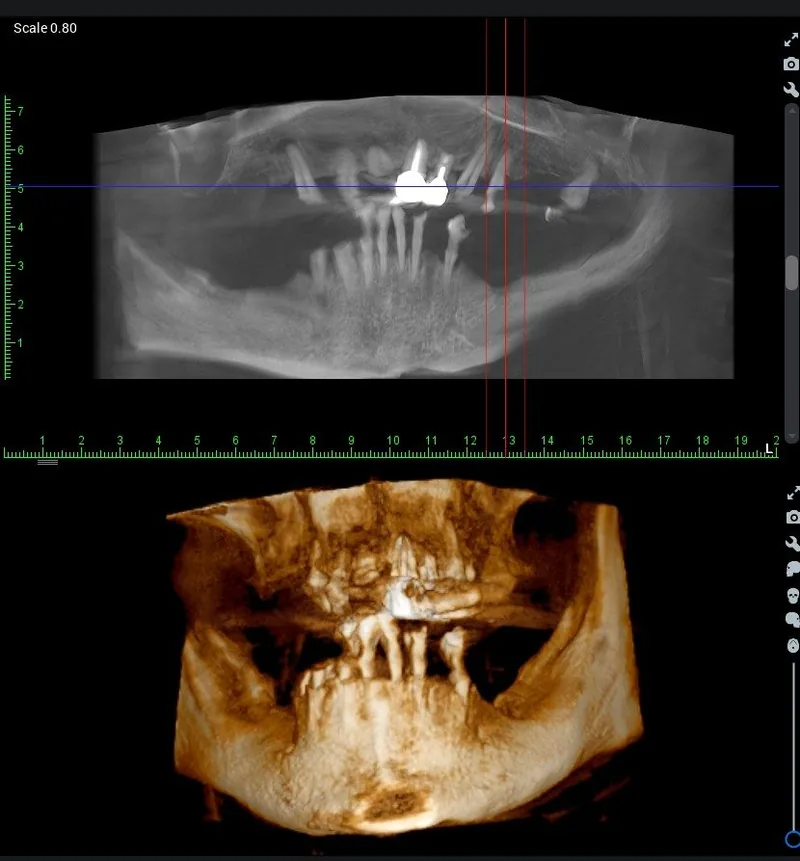 CBCT 3D snimka
