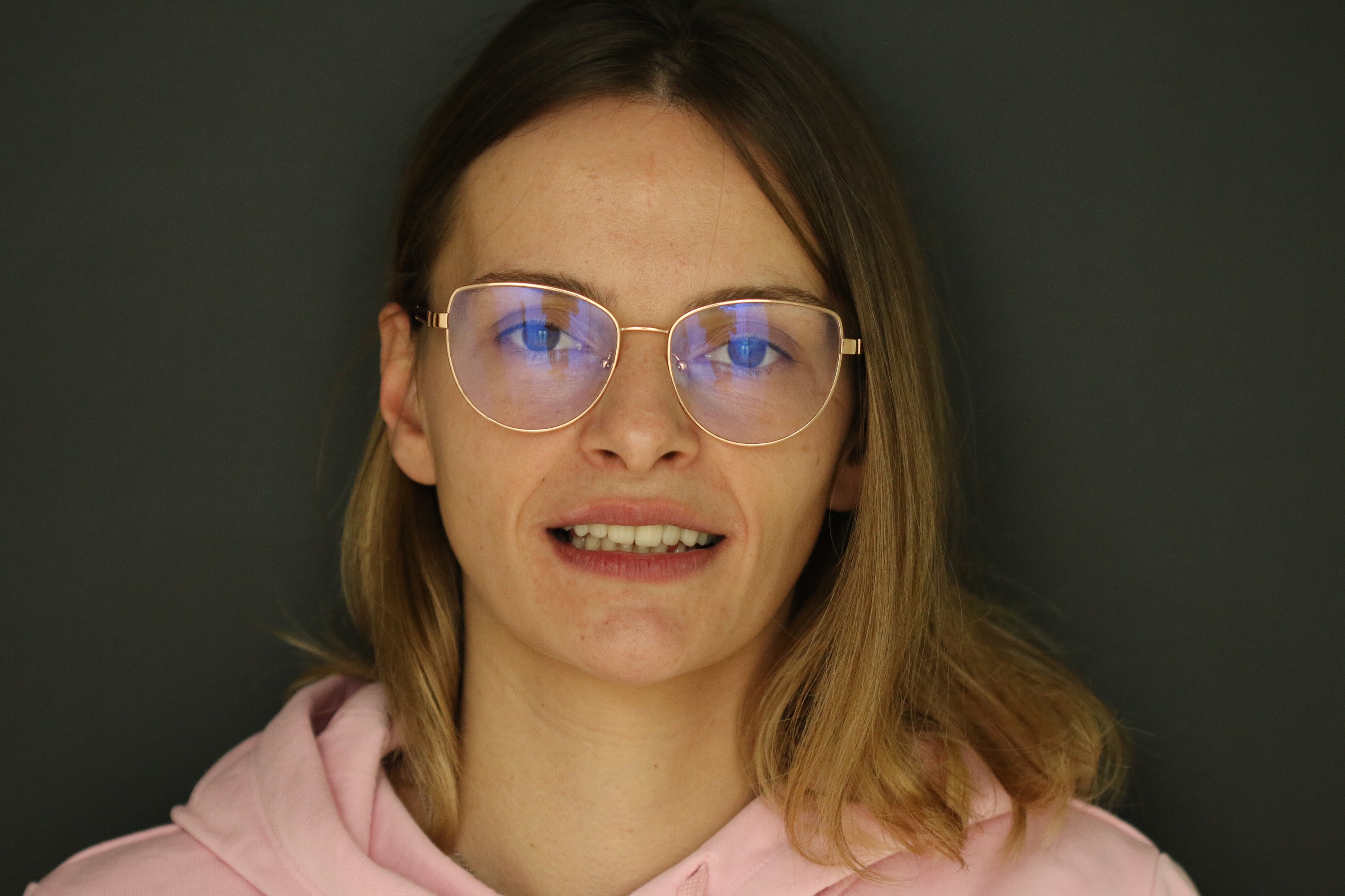 Slučaj 02 — poslije